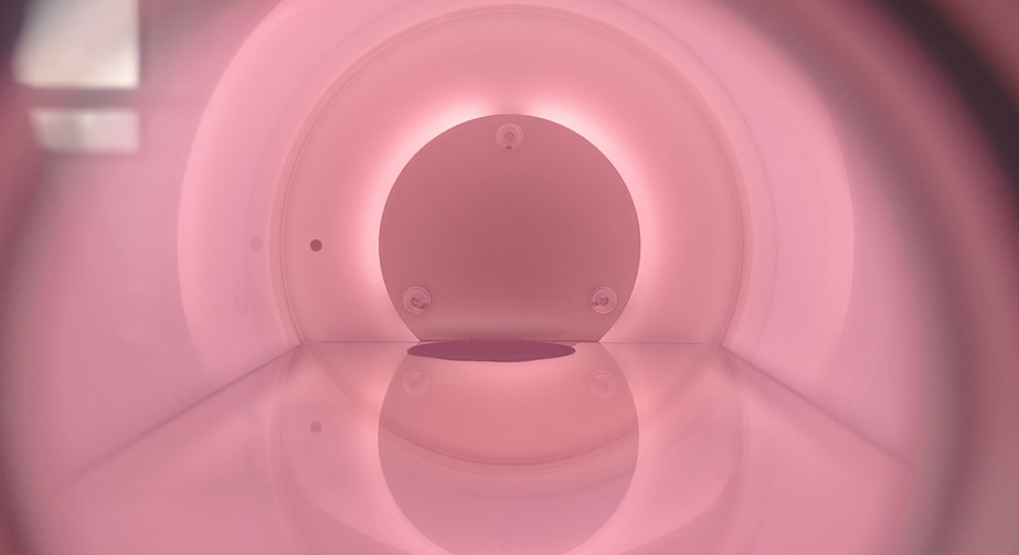 金刚石91短视频在线播放体刻蚀